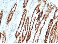 Cadherin-16 Rabbit anti-Human, Mouse, Rat, Clone: CDH16/7028R, Novus Biologicals:Antibodies:Primary